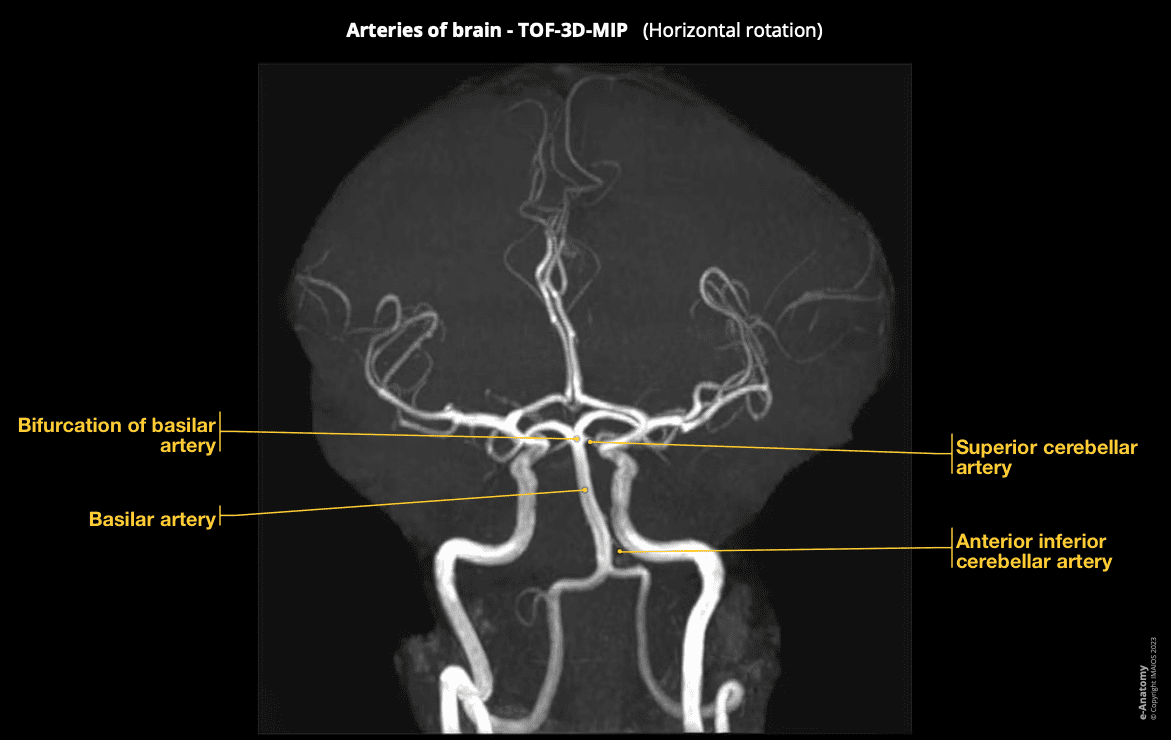 Radiology – MRA 3D — NeurologyResidents