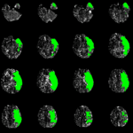 from tissue dissection